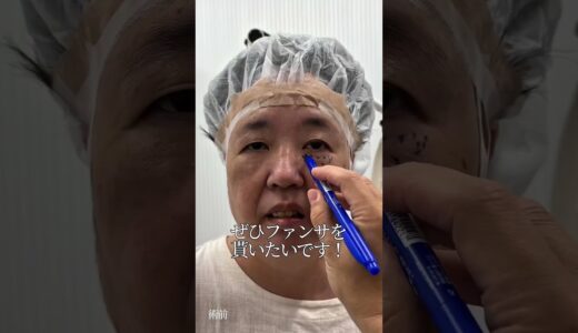 【クマ取り】60代なにふぁむ　ファンサ欲しくて整形決意#shorts