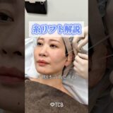 【糸リフト】解説します🎙️#shorts