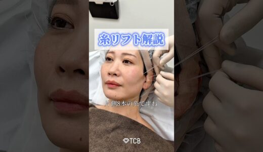 【糸リフト】解説します🎙️#shorts