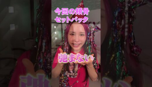 最新の小顔整形！！ウンタイム17日目 『頬骨セットバック』と他院でした『M字リップ』修正、ヴェリテクリニックの福田慶三Dr.にしていただきました🥹