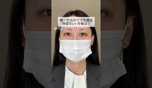 【クマ取り整形】待望の1ヶ月後は？ #shorts