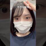 #美容 #整形 #ボトックス