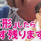 肌再生の専門家が、美容整形の「後遺症」について解説します。