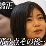 【手術編】輪郭３点、歯科矯正その後、目元の整形へ ┃宮本 友里恵さん┃ 9人目┃美容整形版令和の虎【東京美容外科】