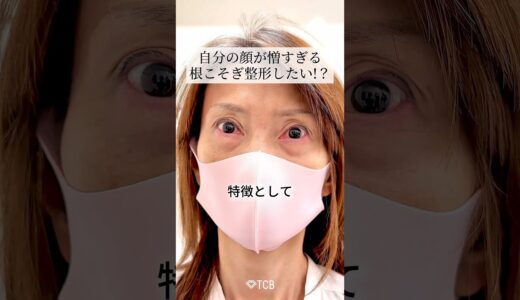 【クマ取り】自分の顔が憎すぎる。根こそぎ整形したい⁉︎#shorts