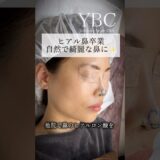 ヒアル鼻卒業✨ナチュラルで綺麗な鼻に #美容整形 #鼻整形 #ybc横浜美容外科