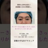 男性の眉下切開の症例　@sunaoclinic  #すなおクリニック #美容整形 #眉下切開