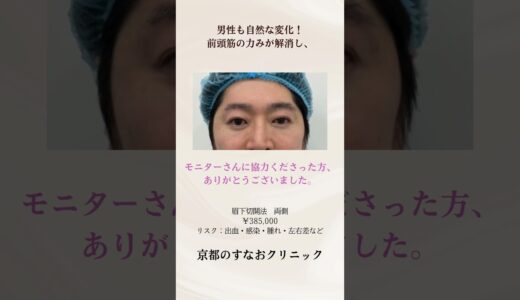 男性の眉下切開の症例　@sunaoclinic  #すなおクリニック #美容整形 #眉下切開