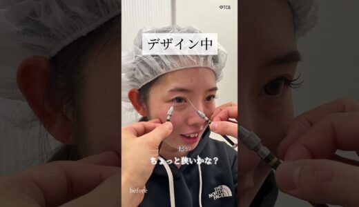 【二重整形】整形する女は嫌だ　説得して整形#shorts