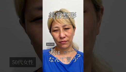 【クマ取り】美容整形夫は何て言う❓#shorts