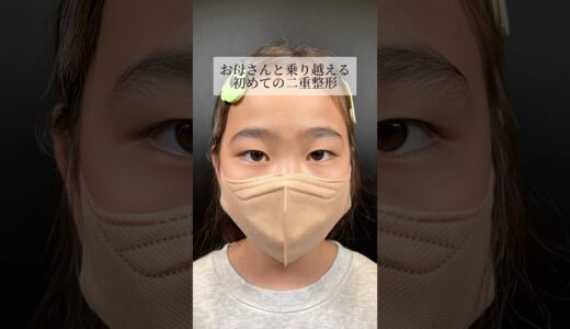 【二重整形】#shorts お母さんと乗り越える初整形