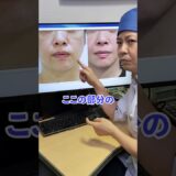 【口元が劇的に若返る】マリオネットラインを消す方法 #shorts