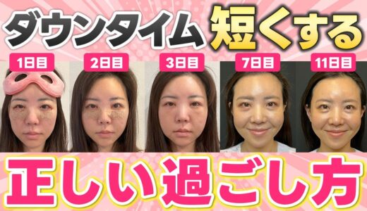 【美容整形を受けたい方必見】ダウンタイム中に腫れやすい人・内出血が出やすい人の特徴を専門医が解説！