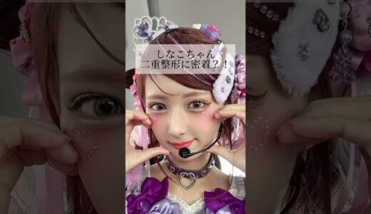 【二重整形】#shorts しなこちゃん整形に密着？！
