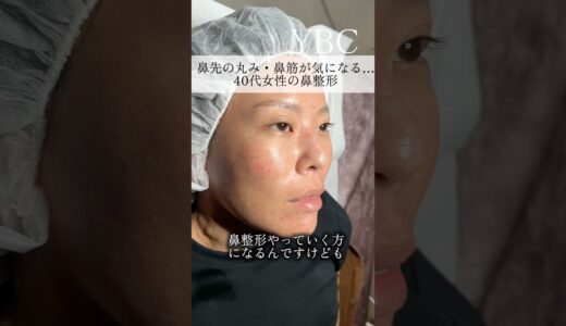 念願の鼻整形したら　#美容整形 #鼻整形 #ybc横浜美容外科