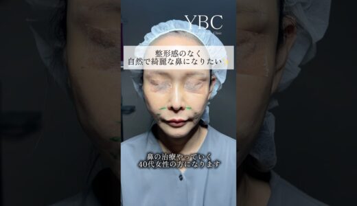 念願の鼻整形したら　#美容整形 #鼻整形 #ybc横浜美容外科