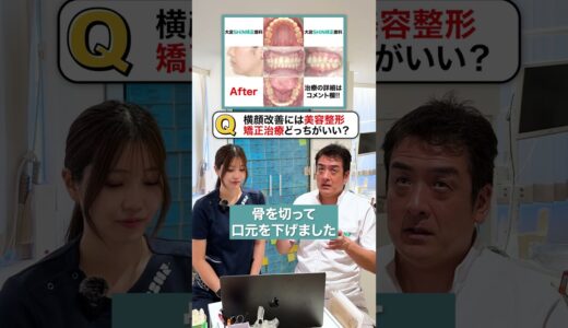 横顔改善には歯列矯正？美容整形？#美容整形 #歯列矯正 #大宮shin矯正歯科