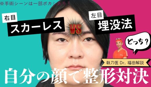【美容整形ホントの話 #4】現役医師が自分の顔で整形対決! 右【スカーレス】vs 左【埋没法】勝つのはどっち!?