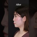 絶対損しない美容医療って⁉️#美容整形