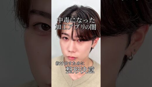 【クマ取り】中毒になった加工アプリの闇。抜け出すために整形決意#shorts