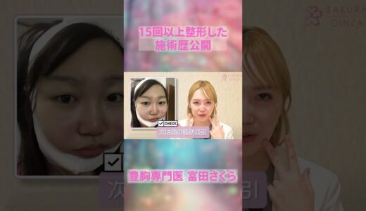 15回以上整形した美容外科の整形レビュー