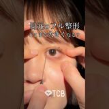 【二重整形】目元のフル整形どこまで大きくなる？？#shorts