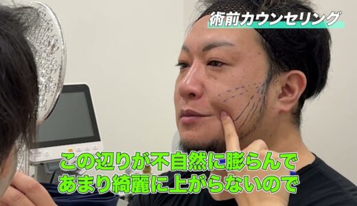 【整形】美容整形してきました！！