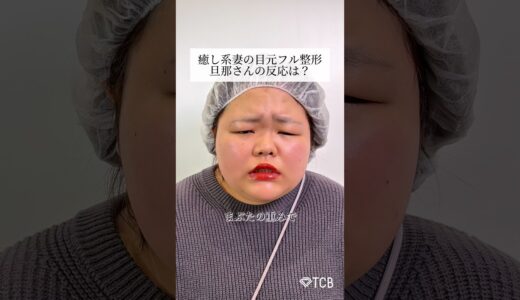 【二重整形】癒し系妻の目元フル整形！旦那さんの反応は？#shorts