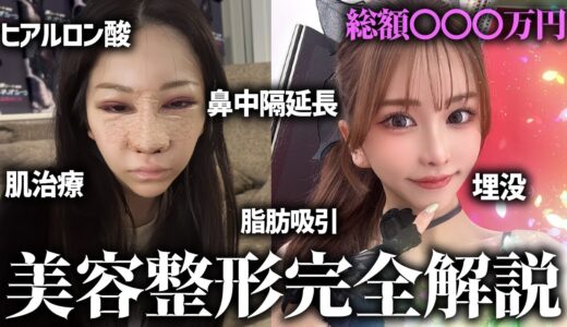 【初公開】私の美容整形について告白します。