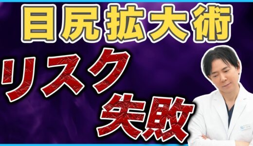 【美容整形】目尻拡大術のリスクや失敗を徹底解説