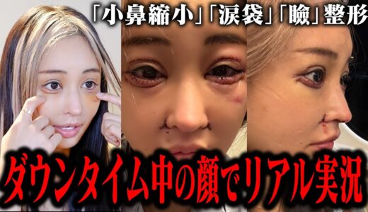【激しくやりました】メンテナンスも含めて今回の整形ポイントをお話します。