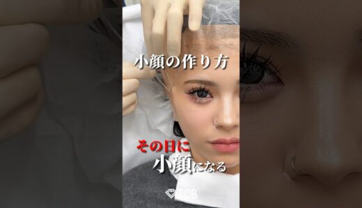【糸リフト】小顔にアップデートしよ？#shorts