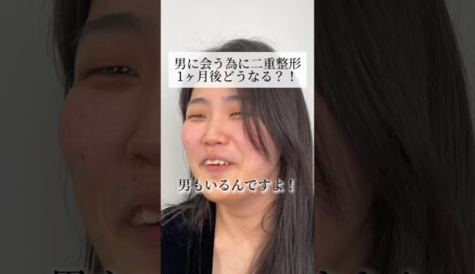 男に会う為に二重整形！1ヶ月後どうなる？！#shorts #二重整形 #二重埋没 #ダウンタイム #整形 #美容整形 #池袋 #東京