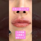 Cカールリップで垢抜け❤️ #shorts #美容 #美容整形 #ビフォアーアフター #垢抜け #整形
