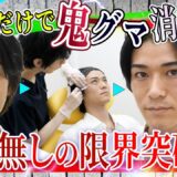 【整形級若返り】目の下のクマ・たるみを消す方法はベビーコラーゲン👶ヒアルロン酸注射だけで−10歳レベル【手術なし・30代イケメンさんクマ取り大成功】湘南美容クリニック
