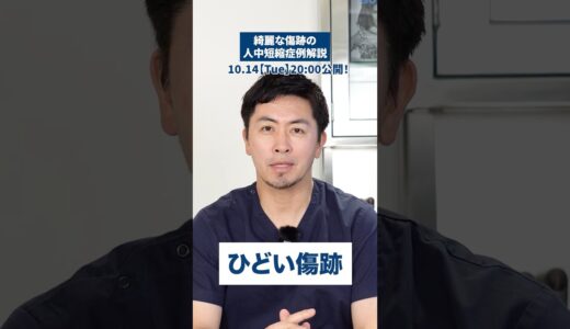 綺麗な傷跡の人中短縮症例解説！#shorts  #整形 #美容整形#美容クリニック #ビスポーククリニック #鼻整形