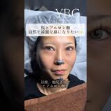 ヒアルロン酸卒業！念願の鼻整形したら　#美容整形 #鼻整形 #ybc横浜美容外科