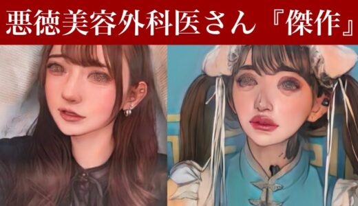 【悲報】悪徳美容外科医さんで鼻フル五角形鼻、顎下脂肪吸引で輪郭整形した結果、悲劇が起きる。。