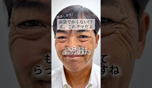 【クマ取り】涙袋でかくない!？え、これクマだよ#shorts