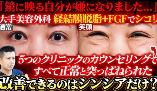 【クマ治療修正】非常に危険なFGF(成長因子)治療を受けて目の下にしこりが…！膨らみすぎた目元の修正治療と美容医療で失敗しないための知識をお伝えします。