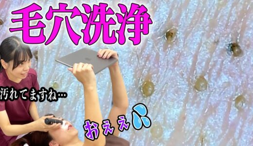 【毛穴洗浄】美女の毛穴を全国公開！話題のハイドラクレンジングで毛穴撲滅