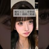 【二重整形】#shorts 術後１週間まで密着