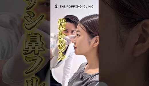 【傷ナシ鼻フルでナチュラルに鷲鼻修正】