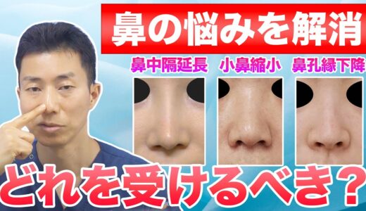 【鼻整形】鼻中隔延長と小鼻縮小と鼻孔縁下降を徹底比較｜自分はどれを受けるべき？