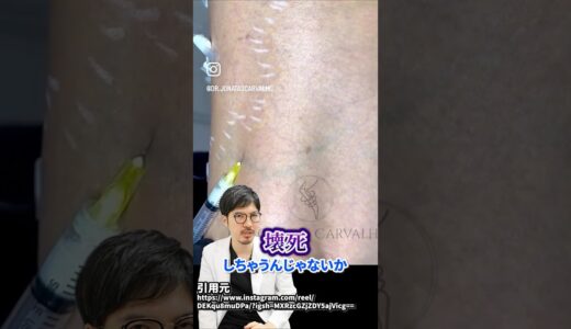 手の甲は絶対にやらないで#脂肪注入 #整形 #美容 #美容整形 #手の甲のボコボコ #額こめかみ #頬コケ #shorts