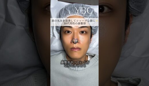 念願の鼻整形したら　#美容整形 #鼻整形 #ybc横浜美容外科