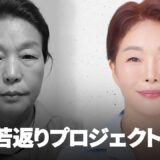 中年レジェンド整形手術レビュー│切開リフト、額挙上、顔の脂肪吸引、脂肪移植、上下眼瞼ぜんぶしました😮