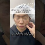 勇気を出して小顔整形したら　#美容整形 #小顔整形 #脂肪吸引