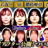 【整形ONE CHANGEドクターバトル#1 | 完結編】ついにアフター公開！若返りvs豊胸vs脂肪吸引vs鼻！ 藤森＆ひろゆき＆川村エミコも仰天！
