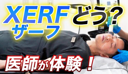 医師が自ら受けてみた高周波ザーフ｜痛み・赤み・効果をリアルレビュー
